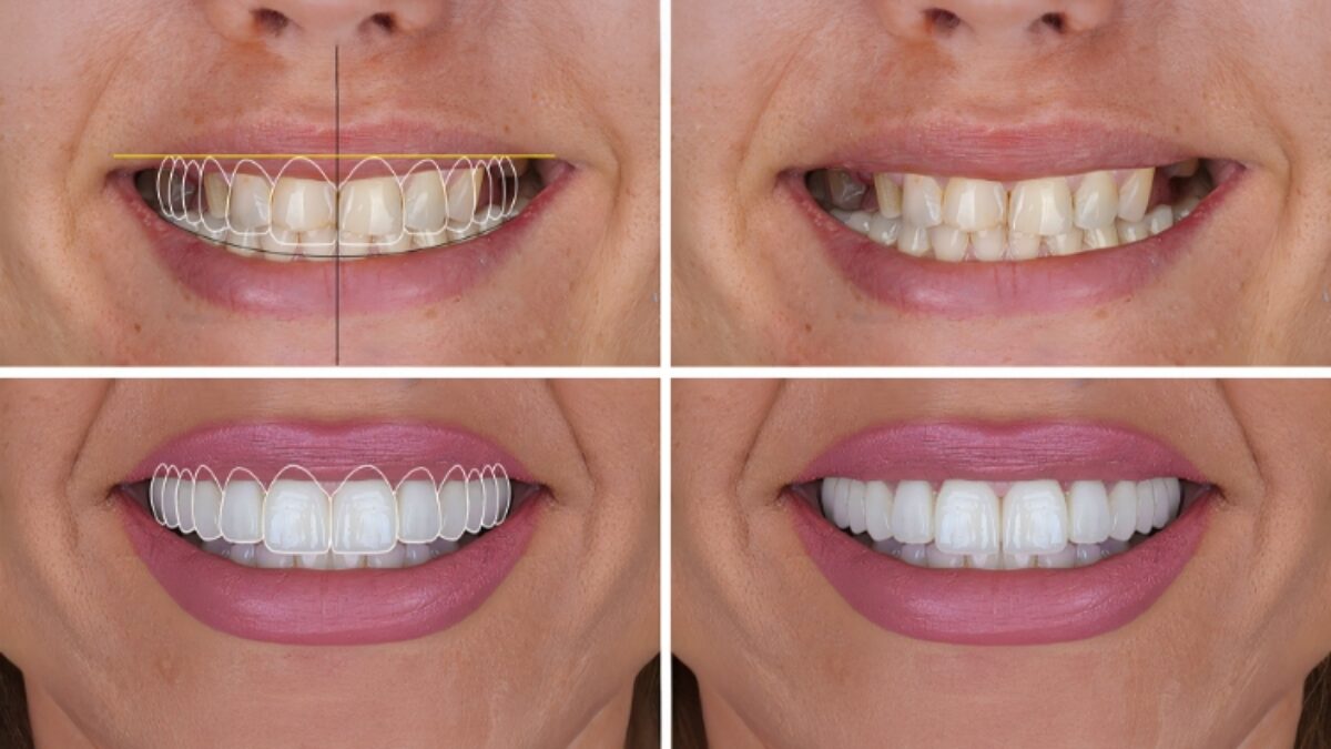 Cosmetic Dentistry Toronto